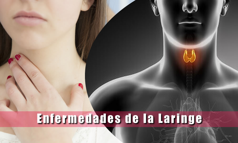 enfermedades de la laringe 1