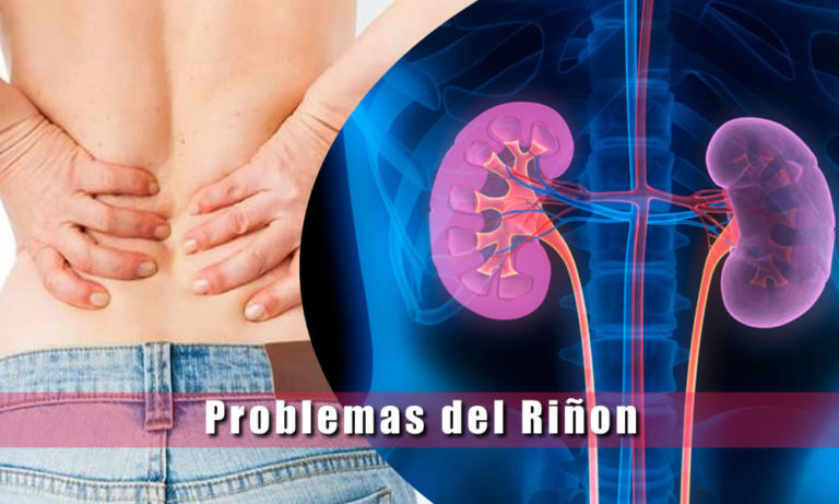 Enfermedades De Los Riñones Tumores Cálculos Insuficiencia Renal Y Más