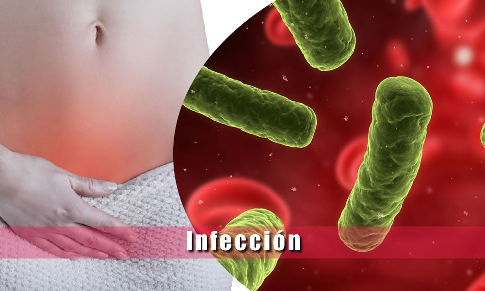 infeccion Causas sintomas virus y bacterias