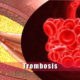trombosis causas sintomas y tratamiento de la trombosis